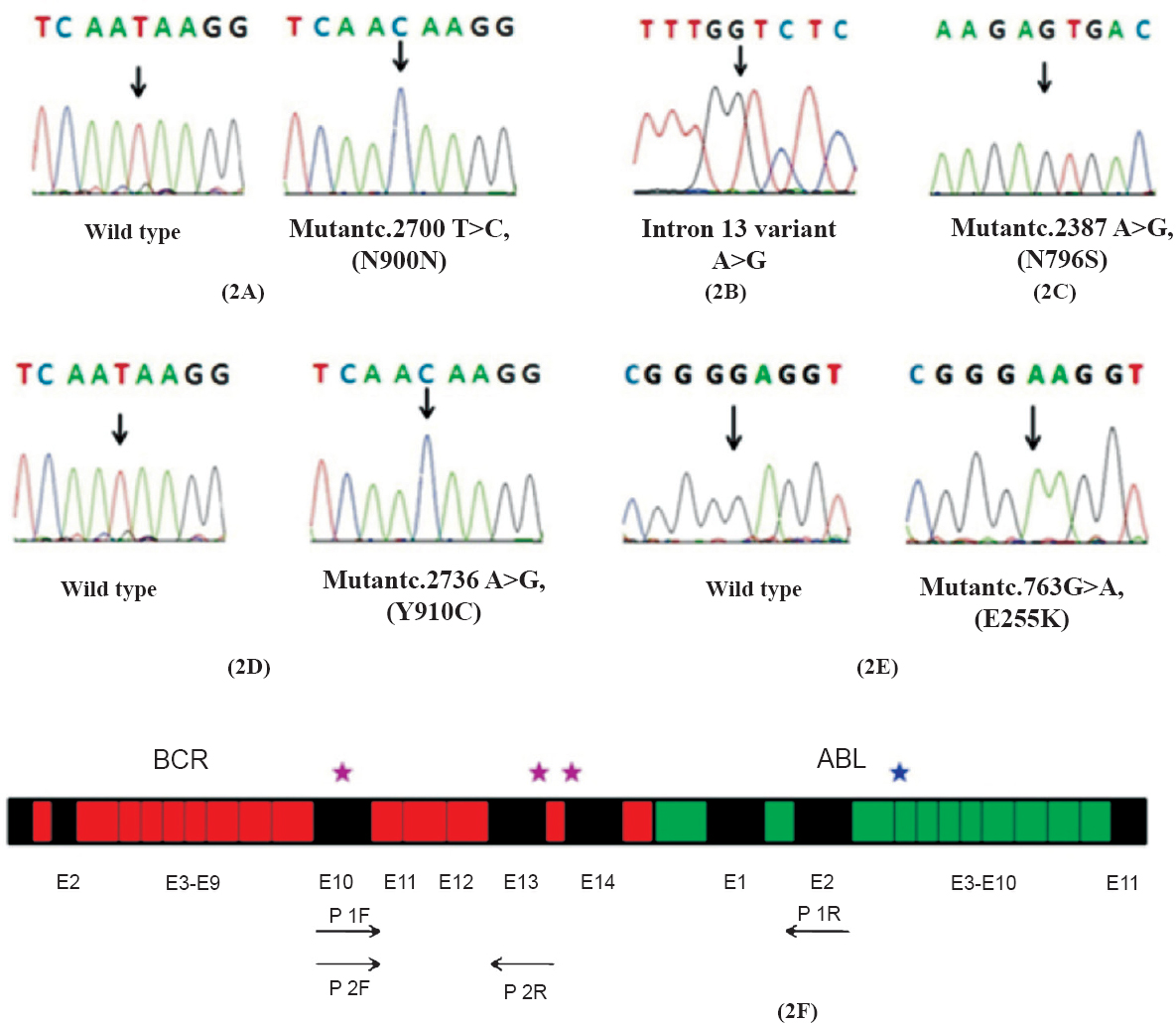 Electropherogram of wild type and mutant alleles of patients 1- 8. The mutation sites are indicated by arrows (Fig. 2A-2E) and schematic representation of the various polymorphisms, mutations are represented by asterisks (*) and the positions of the primers are indicated by arrows in Fig. 2F.